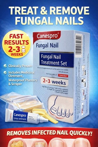 Canespro fungal nail treatment - canespro,